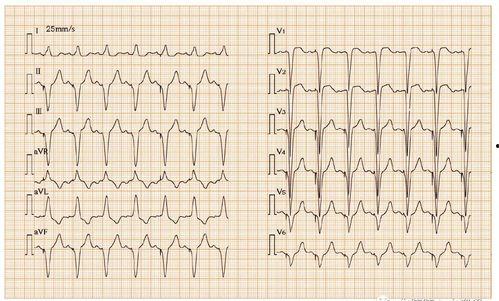 十二个心房,探寻人体生命奥秘的旅程